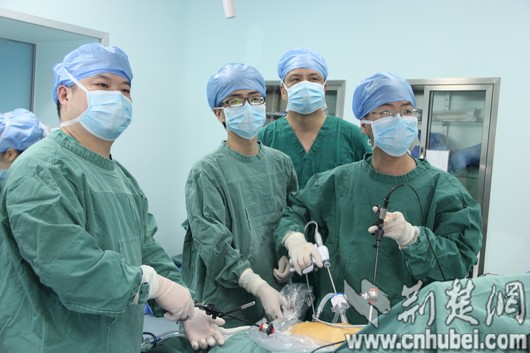 石首市人民医院成功开展首例腹腔镜下脾切除术
